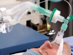 إسرائيل تعرب عن استعدادها لتزويد مستشفيات لبنان بأجهزة تنفس اصطناعي