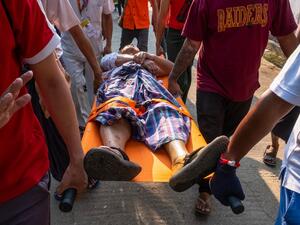 People carry an injured resident shot with rubber bullets 