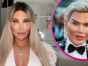 المتحول الجنسي جيسيكا ألفيس