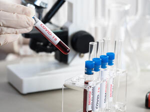 WHO said it was "extremely unlikely" that the virus spread from a Wuhan lab