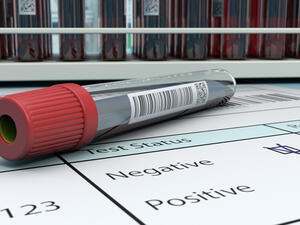 Watch out! Fake Covid tests on the Increase!