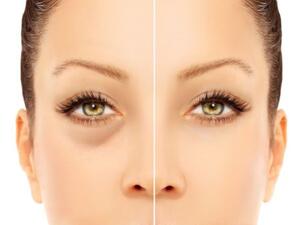 استخدام مستحضرات التجميل. إذا كنتِ ترغبين في إخفاء الهالات أسفل العين