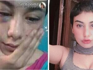 منة عبد العزيز