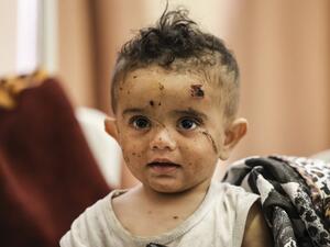 A Palestinian girl, who was wounded in overnight Israeli air strikes on the Gaza Strip, receives treatment at Al-Shifa Hospital in the Palestinian enclave on May 16, 2021. Mahmud hams / AFP Israeli military will continue missiles strike on Gaza