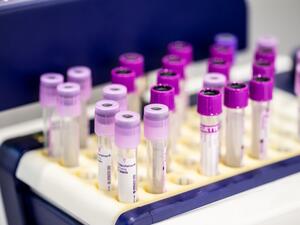 Medlab Middle East To Address Increased Demand For Covid-19 Testing