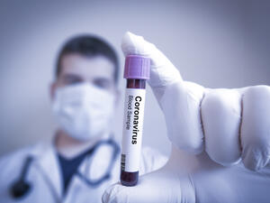 covid-19 cases are below 1000 in saudi arabia