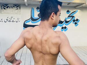 Furqan bin Imran suffers from a very rare type of skeletal abnormality called pycnodysostosis. 