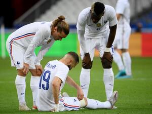 France striker Karim Benzema limped out of Tuesday's friendly against Bulgaria in a worrying sight for Les Bleus. (Photo: AFP)