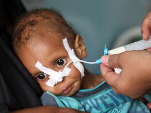 Hunger increased since the beginning of the coronavirus pandemic