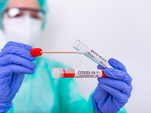 PCR test