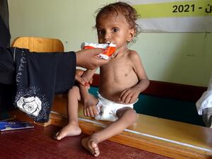Yemenis set to face famine and related diseases.