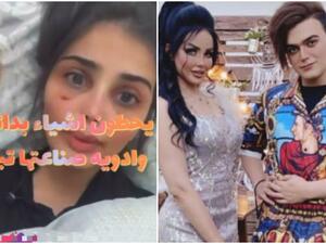 شهاب وصباح / الفتاة صاحبة العملية التجميلة الفاشلة