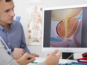 أعراض البروستاتا عند الرجال