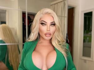 جيسيكا ألفيس