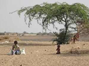 75% of Yemeni kids suffer from acute malnutrition