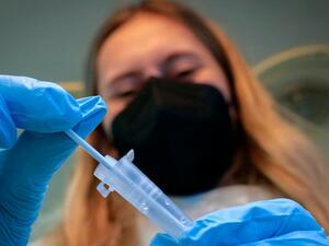 بعض الدول لم تصل الى مستوى تطعيم 10 بالمئة من السكان 