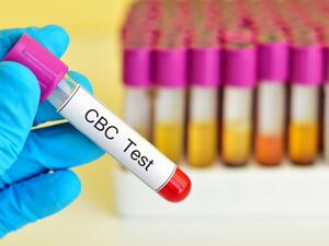 ما هو فحص تعداد الدم الكامل CBC؟