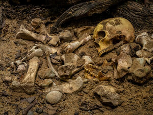 human bones