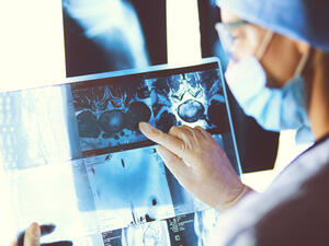 A new Lancet Oncology Commission finds that annual cancer deaths in sub-Saharan Africa (SSA) could reach 1 million by 2030