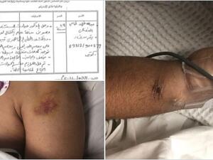تعذيب المواطن عبد الله طامي