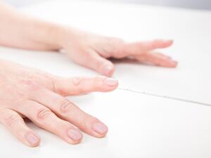 متلازمة الألم الناحي المركب