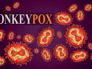 Monkeypox cases