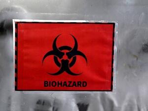 تسجيل أول إصابة لامرأة في الهند بجدري القردة