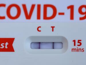 A positive Covid-19 at home test is displayed on May 02, 2022 in San Anselmo, California. (Photo Illustration by Justin Sullivan/Getty Images) (Photo by JUSTIN SULLIVAN / GETTY IMAGES NORTH AMERICA / Getty Images via AFP)