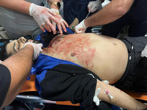 3 شهداء في نابلس