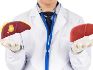 مرض الكبد الدهني: احذروا هذه العلامات الخطيرة