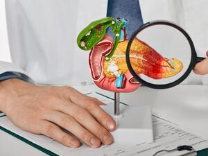 طبيب البوابة: أعراض سرطان القناة الصفراوية والعلاج