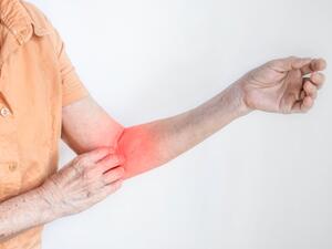 ينتقل مرض الجرب بسهولة عن طريق الاتصال المباشر بجلد الشخص المصاب