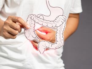 طبيب البوابة: 5 طرق للتخلص من الإمساك المزمن