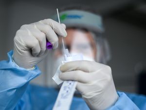 المتحور (BA.2.86) يخضع للمراقبة بسبب وجود عدد كبير من الطفرات فيه
