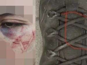 جنود اسرائيليون يحفرون نجمة داوود في وجه اسير فلسطيني