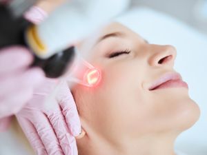 Laser skin resurfacing