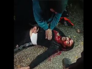 فلسطينية تحاول انعاش ابنها المصاب في جنين