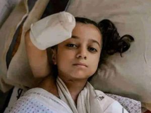 طفله فلسطينية فقدت احد اطرافها نتيجة العدوان على غزة