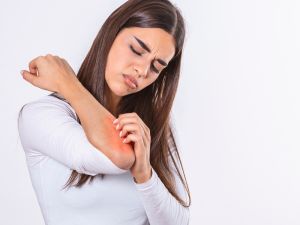 طبيب البوابة: أسباب حكة الجلد في الشتاء وطرق علاجها