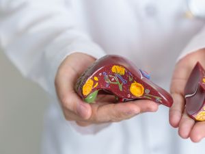 طبيب البوابة: استراتيجيات صحية لعلاج الكبد الدهني 