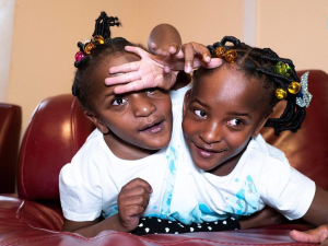 Instagram (people) conjoined twins