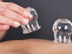 أفضل أوقات لعمل الحجامة في رمضان، وهل تفطر ؟