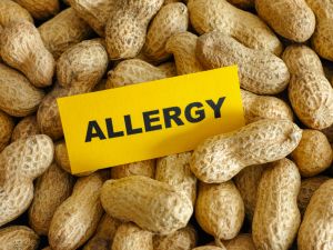food allergies