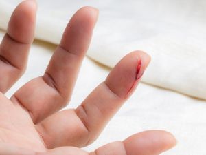 ما رمزية الحلم بقطع إصبعك في المنام؟