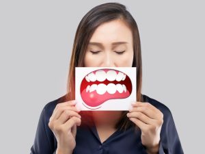 أفضل وصفة لعلاج التهاب اللثة في المنزل