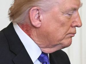 "بقعة حمراء" في رقبة ترامب