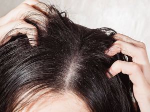 تفسير حلم حشرات الشعر
