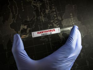 Hantavirus