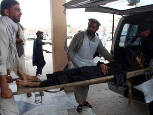 A wounded Afghan lies on trolley as he is rushed to hospital following a blast (AFP/File Photo)	