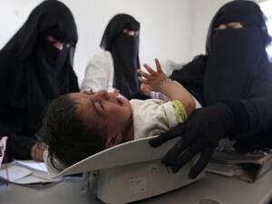 A Yemeni nurse weighs a child at a medical center on the outskirts of the Yemeni capital Sanaa, on Jan. 6, 2018 (MOHAMMED HUWAIS / AFP) 
